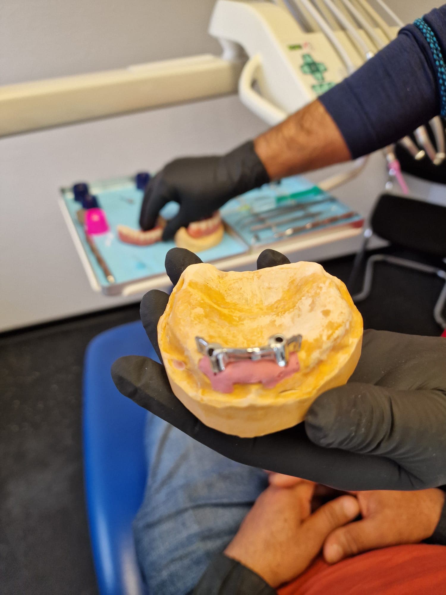 zahnersatz_auf_implantate 1.jpg