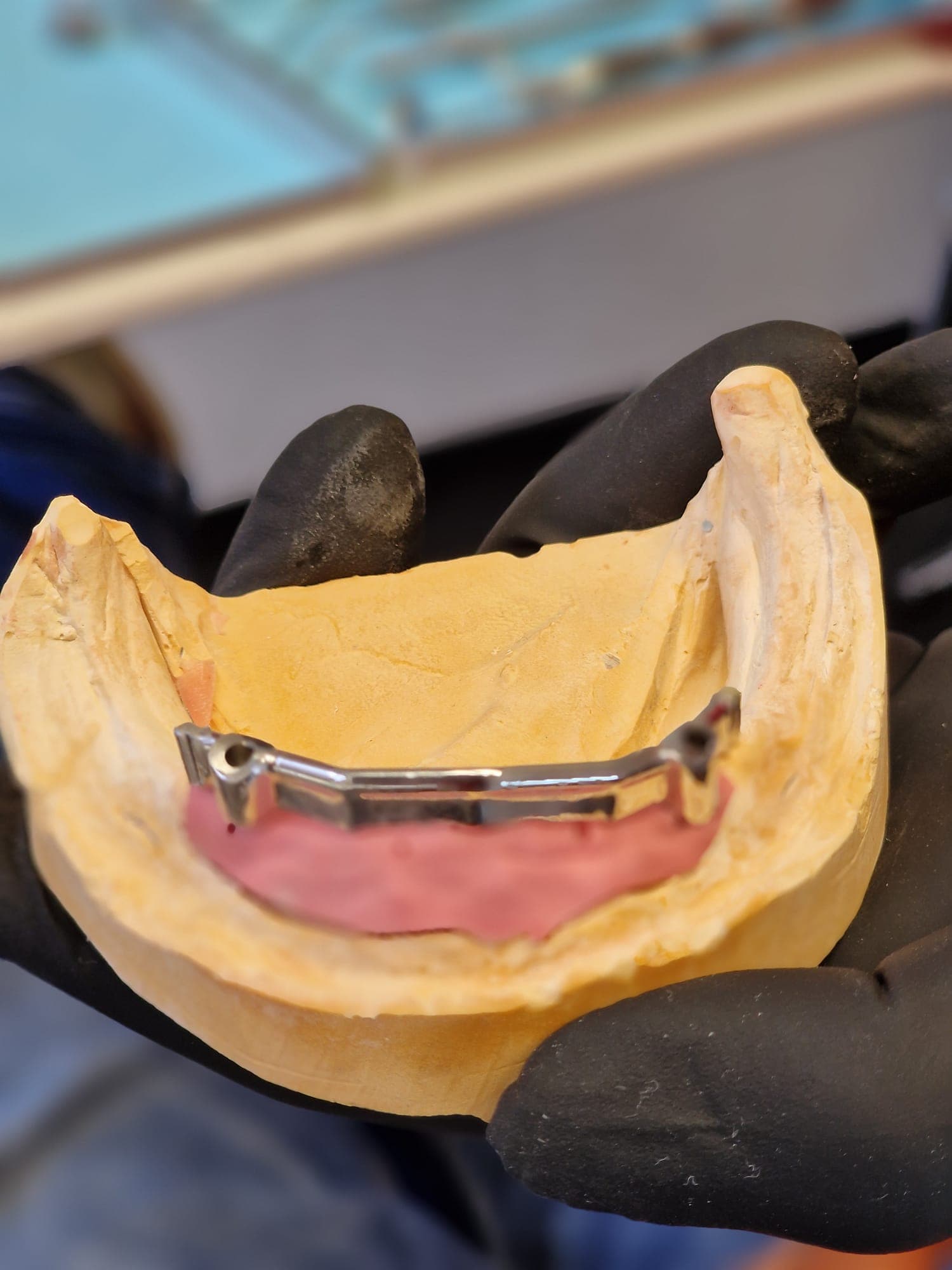 zahnersatz_auf_implantate 2.jpg