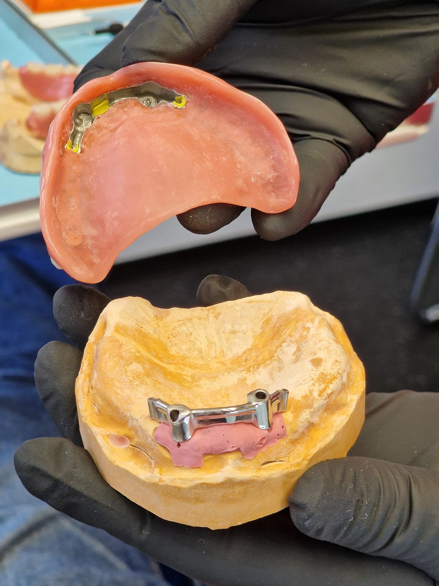 zahnersatz_auf_implantate 3.jpg