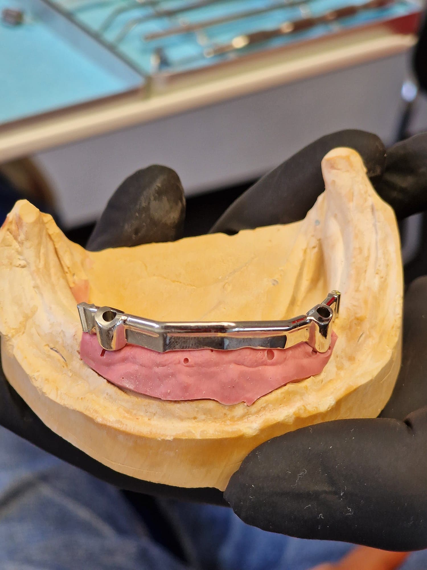 zahnersatz_auf_implantate 5.jpg